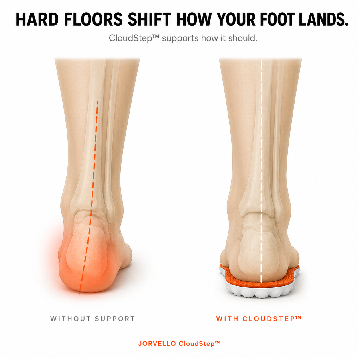 Jorvello CloudStep™ Insoles